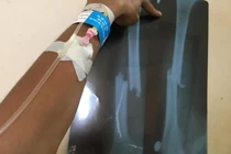 Cái kết của nam thanh niên vội đi gặp người yêu cũ trước ngày lên xe hoa