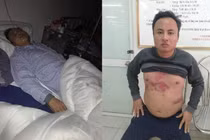 Tài xế phản đối BOT tiết lộ nguyên nhân bị đánh gãy xương sườn