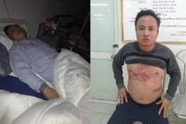 Tài xế phản đối BOT tiết lộ nguyên nhân bị đánh gãy xương sườn