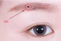 Người có 4 nốt ruồi này vừa giàu vừa sang, cả đời phú quý