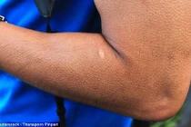 Người có khả năng kỳ lạ do lỗi... gene