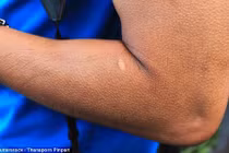 Người có khả năng kỳ lạ do lỗi... gene