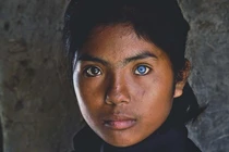 Những đôi mắt dị thường hiếm gặp nhất trên thế giới