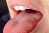 Sự thực xót xa chiếc lưỡi dài “quái vật” của cậu bé tội nghiệp