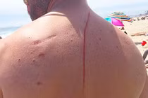 Kỳ lạ: Nếu không nhờ cá mập cắn, anh chàng này đã mất mạng