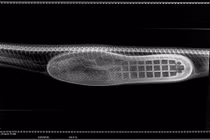 Trăn mắc nghẹn vì... nuốt nguyên chiếc giầy