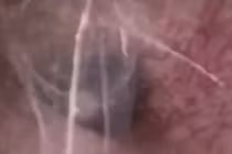 Kinh dị nhện xâm chiếm giăng tơ trong tai người