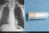 Chuyện lạ hôm nay: Cậu bé ho ra tiếng sáo, sự thật gây sốc...