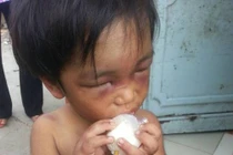 Bé trai 3 tuổi bị người thân tra tấn dã man