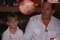 Thiên thạch rơi trúng đầu bé trai 7 tuổi