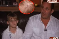 Thiên thạch rơi trúng đầu bé trai 7 tuổi