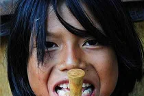 “Rùng mình” màn xuyên xương khỉ qua môi...làm đẹp