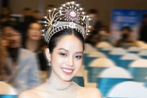 Vừa đăng quang, Hoa hậu có nên phẫu thuật thẩm mỹ?