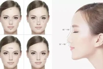 Phẫu thuật thẩm mỹ: Cẩn thận phá tướng, mất hết phúc lộc