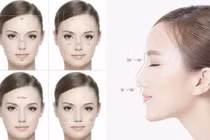 Phẫu thuật thẩm mỹ: Cẩn thận phá tướng, mất hết phúc lộc