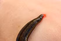 Quảng Nam: Cán bộ thú y gắp con đỉa dài hơn 10cm từ mũi người