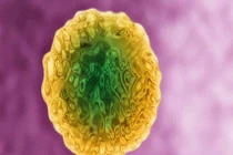 10 đổi mới trong y tế lớn nhất trên thế giới