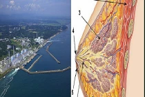 Phóng xạ tại Nhật tăng khả năng gây ung thư vú