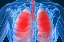 Những triệu chứng phổ biến chứng tỏ bạn bị ung thư phổi