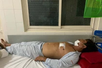 Mâu thuẫn tấc đất, anh trai dùng kéo đâm em nhập viện