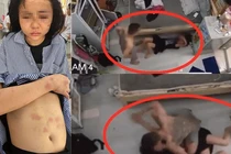 Cô gái Yên Bái bị kẻ yêu đơn phương đánh dã man: Có “xộ khám“?