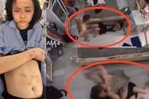 Cô gái Yên Bái bị kẻ yêu đơn phương đánh dã man: Có “xộ khám“?