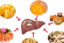 Những thực phẩm “phá nát” gan nhanh hơn bia rượu