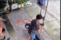 Người đàn ông bắc thang kiểu lạ lùng, hậu quả suýt bó bột