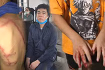 Cha đánh “nát tay” con ở Sài Gòn: Điểm mặt “ác phụ”