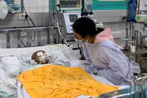 Cháu nhỏ bị dượng cầm kéo đâm xuyên hốc mắt tiên lượng rất nặng