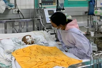 Cháu nhỏ bị dượng cầm kéo đâm xuyên hốc mắt tiên lượng rất nặng