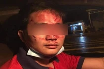 Lời kể của tài xế taxi bị khách đấm túi bụi trên xe 