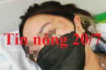 Tin nóng 20/7: Điều tra vụ cô gái tố bị sàm sỡ, hành hung ở Aeon Mall Long Biên 