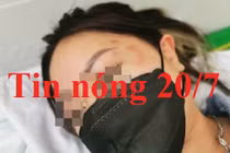 Tin nóng 20/7: Điều tra vụ cô gái tố bị sàm sỡ, hành hung ở Aeon Mall Long Biên 