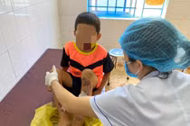 Sức khỏe cháu bé bị bố bạo hành ở Quảng Bình hiện ra sao?