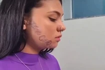 Chàng trai bắt cóc bạn gái rồi xăm tên lên mặt cô