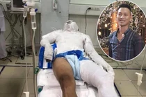 Đổ xăng đốt cháy người ở Nghệ An: Vì 2.5 triệu... thủ đoạn ác ôn?