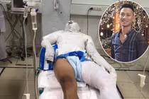 Đổ xăng đốt cháy người ở Nghệ An: Vì 2.5 triệu... thủ đoạn ác ôn?