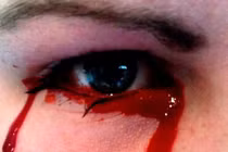 Rùng rợn những người khóc ra máu