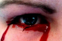 Rùng rợn những người khóc ra máu