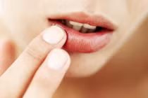 Thấy môi có hiện tượng này, đi khám ung thư miệng ngay kẻo hối hận