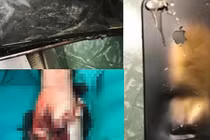 Nổ điện thoại lúc học online, học sinh lớp 5 tử vong