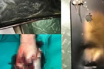 Nổ điện thoại lúc học online, học sinh lớp 5 tử vong