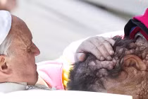 Cảm động giây phút Giáo hoàng ôm bệnh nhân bị u khắp mặt