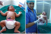 Mẹ 19 tuổi lập kỷ lục sinh con nặng cân nhất thế giới