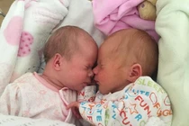 Cặp song sinh phải xét nghiệm HIV vì ăn nhầm sữa mẹ