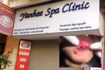 Yanhee Spa Clinic đóng cửa sau nghi án làm hoại tử môi khách