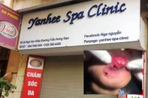Yanhee Spa Clinic đóng cửa sau nghi án làm hoại tử môi khách