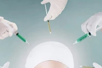 1.001 lý do nói không với làm đẹp bằng dao kéo