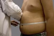 Lính Mỹ đổ xô đi hút mỡ bụng